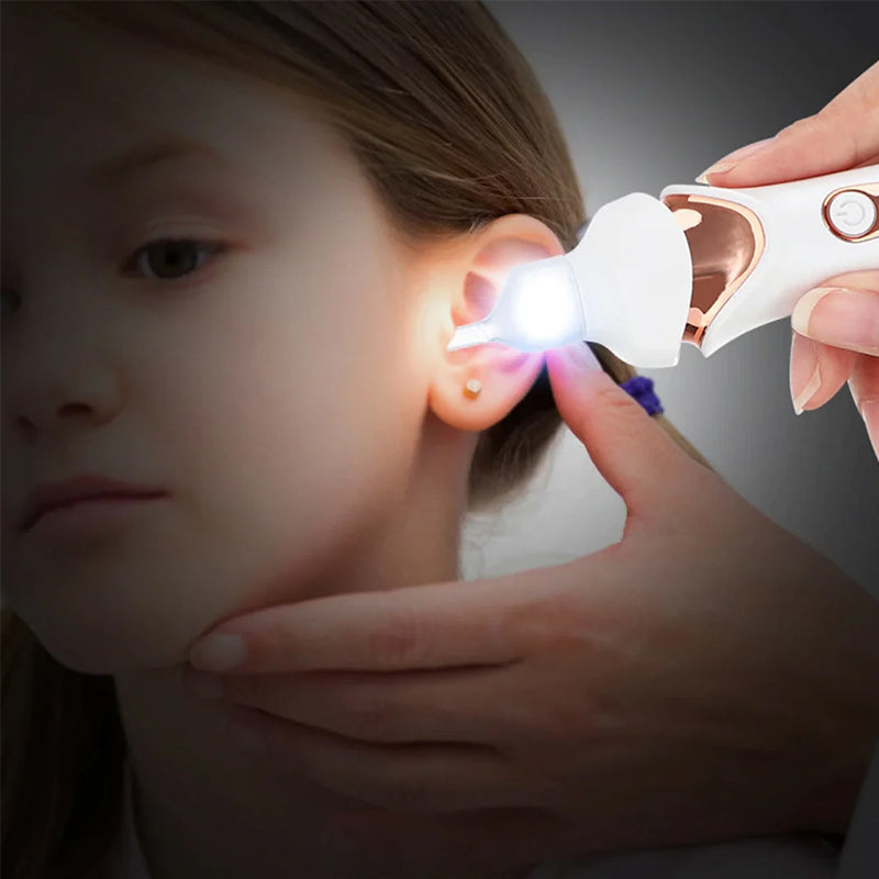 Skorter | 5 in 1 Electric Ear Wax Remover