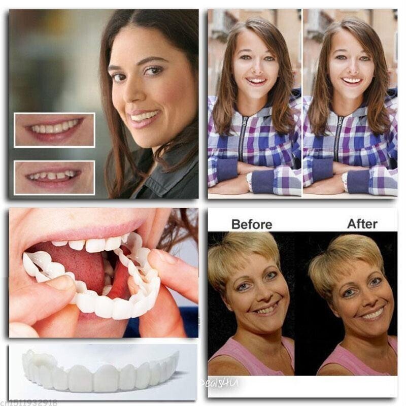 Skorter | Adjustable Snap-On Dentures