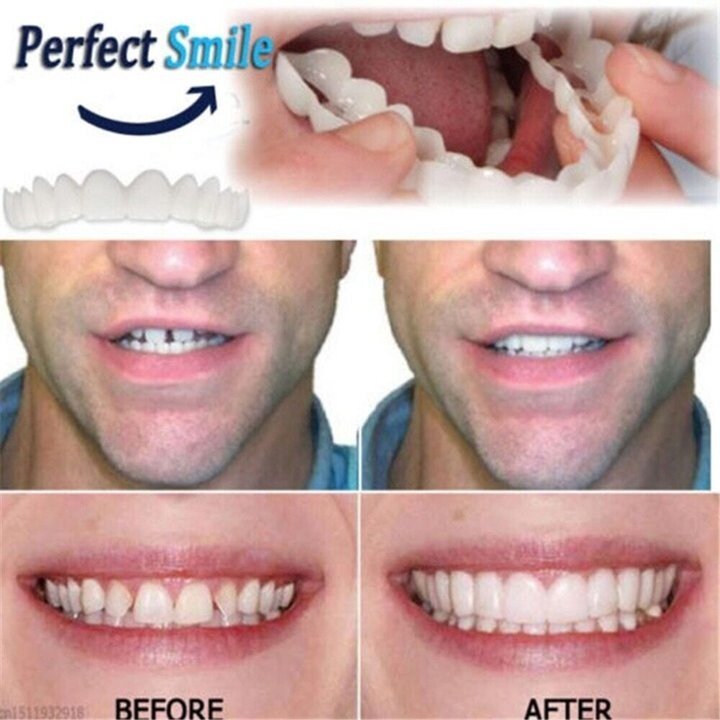 Skorter | Adjustable Snap-On Dentures