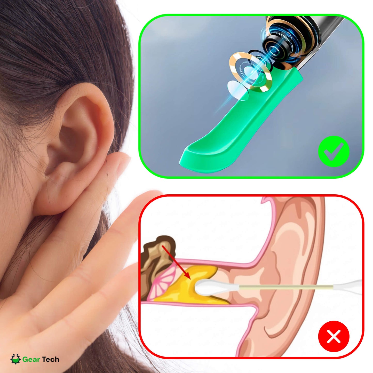 Skorter | EarScope Pro Ear Wax Removal Kit | High-Resolution Camera & LED Lights for Safe Home Use
