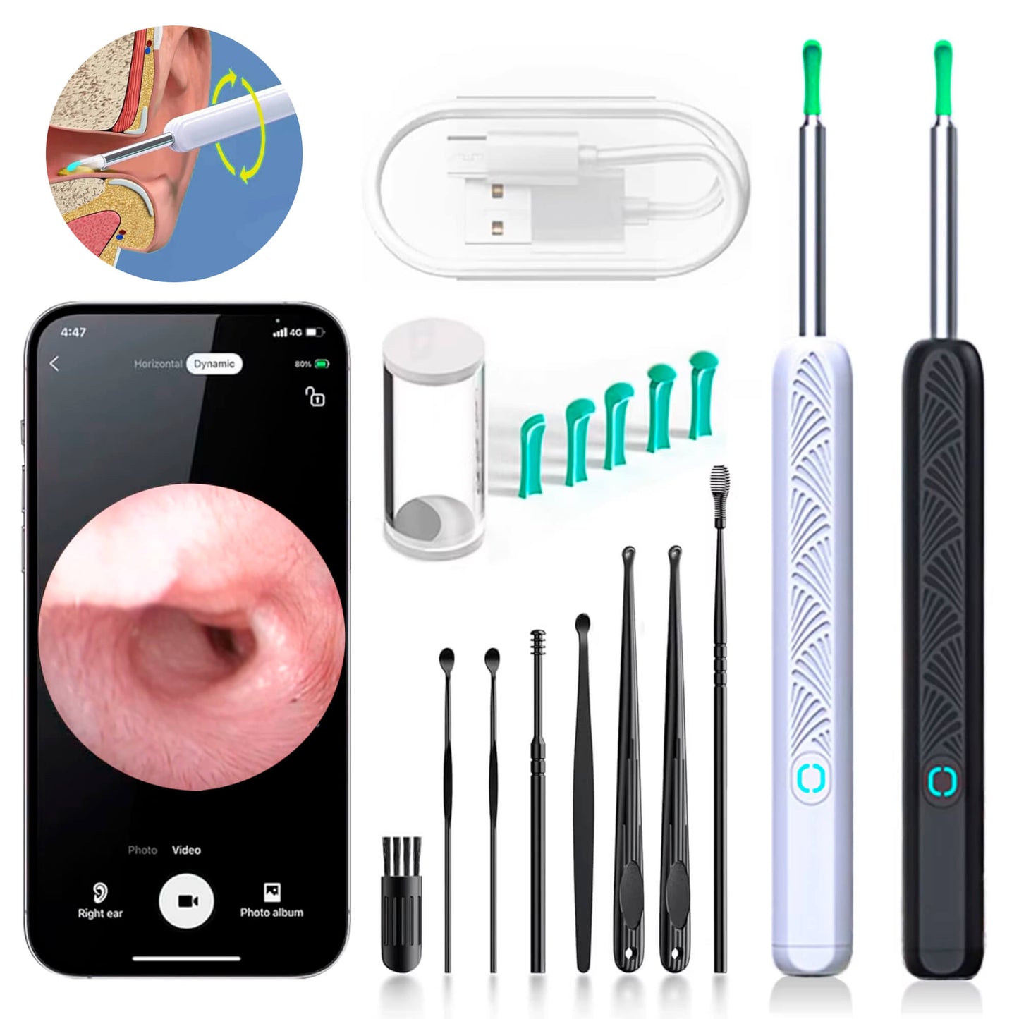 Skorter | EarScope Pro Ear Wax Removal Kit | High-Resolution Camera & LED Lights for Safe Home Use