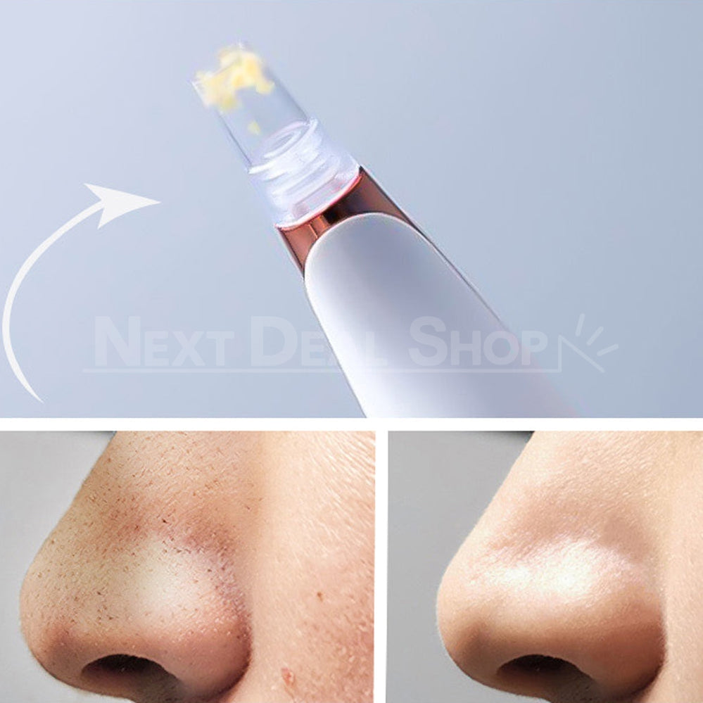 Skorter | Electric Blackhead Remover Pore Vacuum