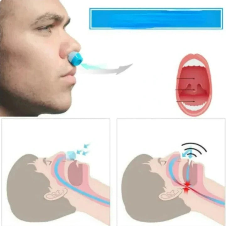 Skorter | 2-in-1 Anti Snore Device and Air Purifier Nose Clip