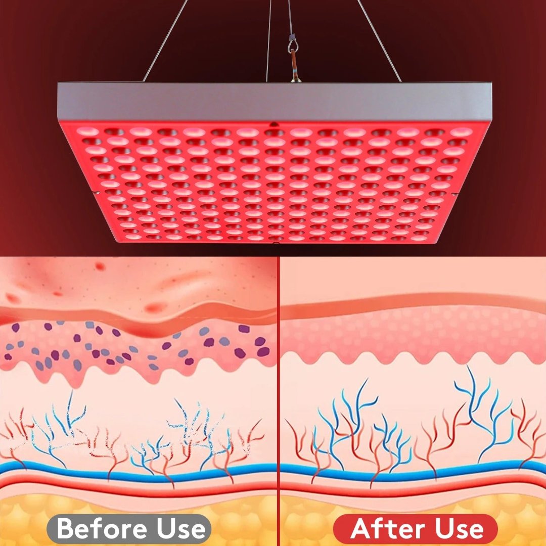 Skorter | Red Light Therapy Lamp Device  – Muscle Recovery and Sleep Aid
