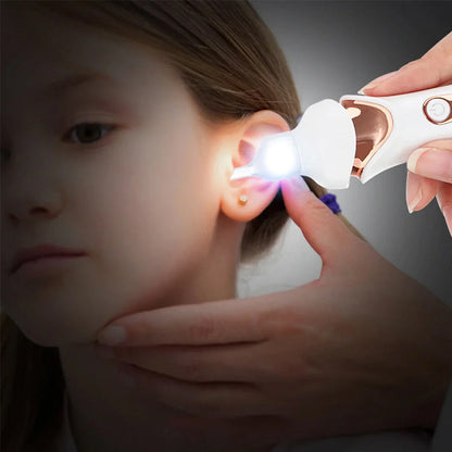 Skorter | 5 in 1 Electric Ear Wax Remover