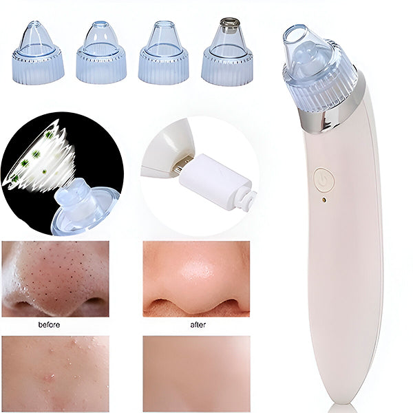 Skorter | 2-in-1 Pore Cleanser and Microdermabrasion Device