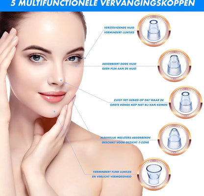 Skorter | Electric Blackhead Remover