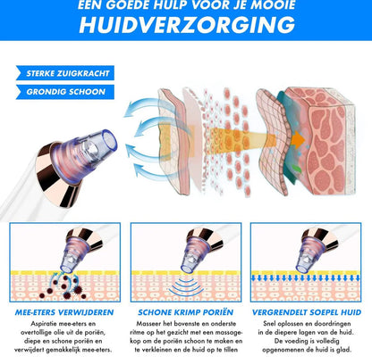 Skorter | Electric Blackhead Remover