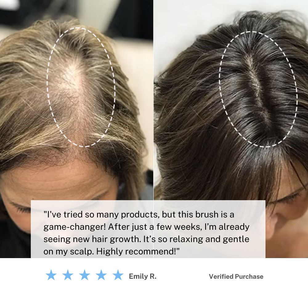 Skorter | Cordless Scalp Massaging Brush – Boost Hair Growth & Relax at Home