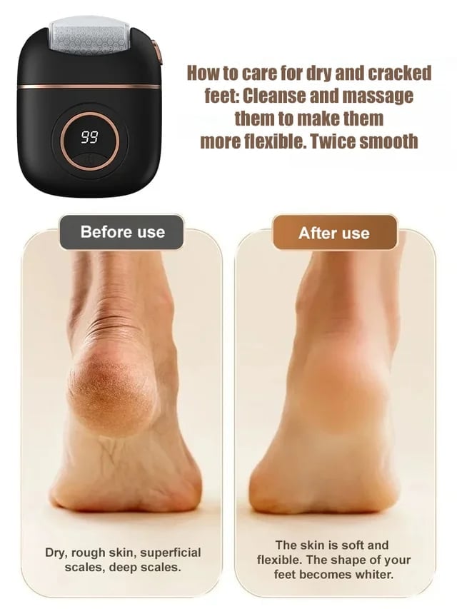 Skorter | 2025 New digital electric foot polishing machine