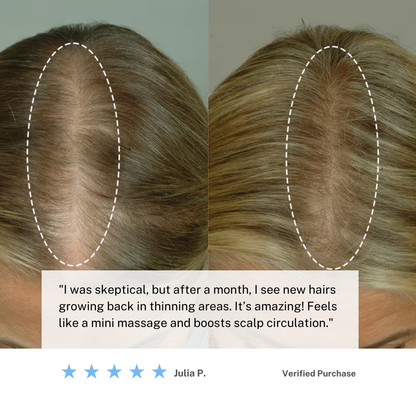 Skorter | Cordless Scalp Massaging Brush – Boost Hair Growth & Relax at Home