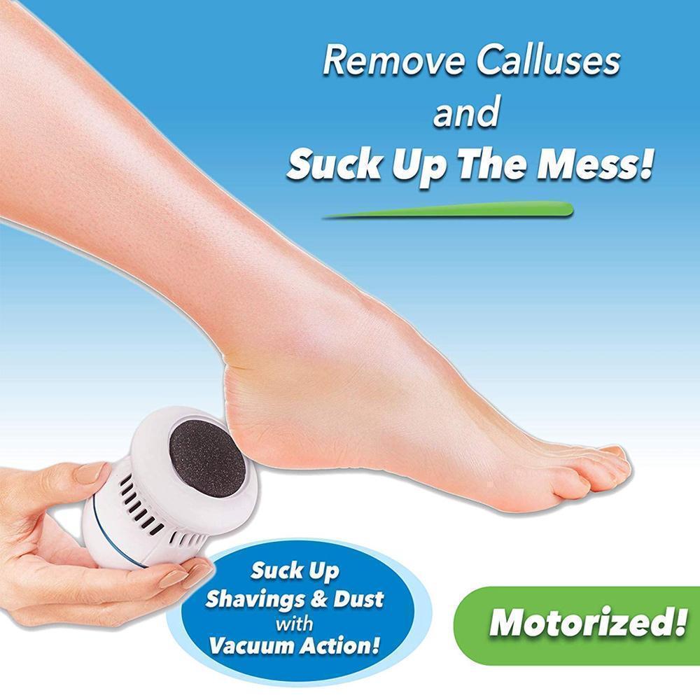 Skorter | FootFile and Callus Remover