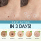 (1 + 1 Free) FlawlessPatch Skin Concealer