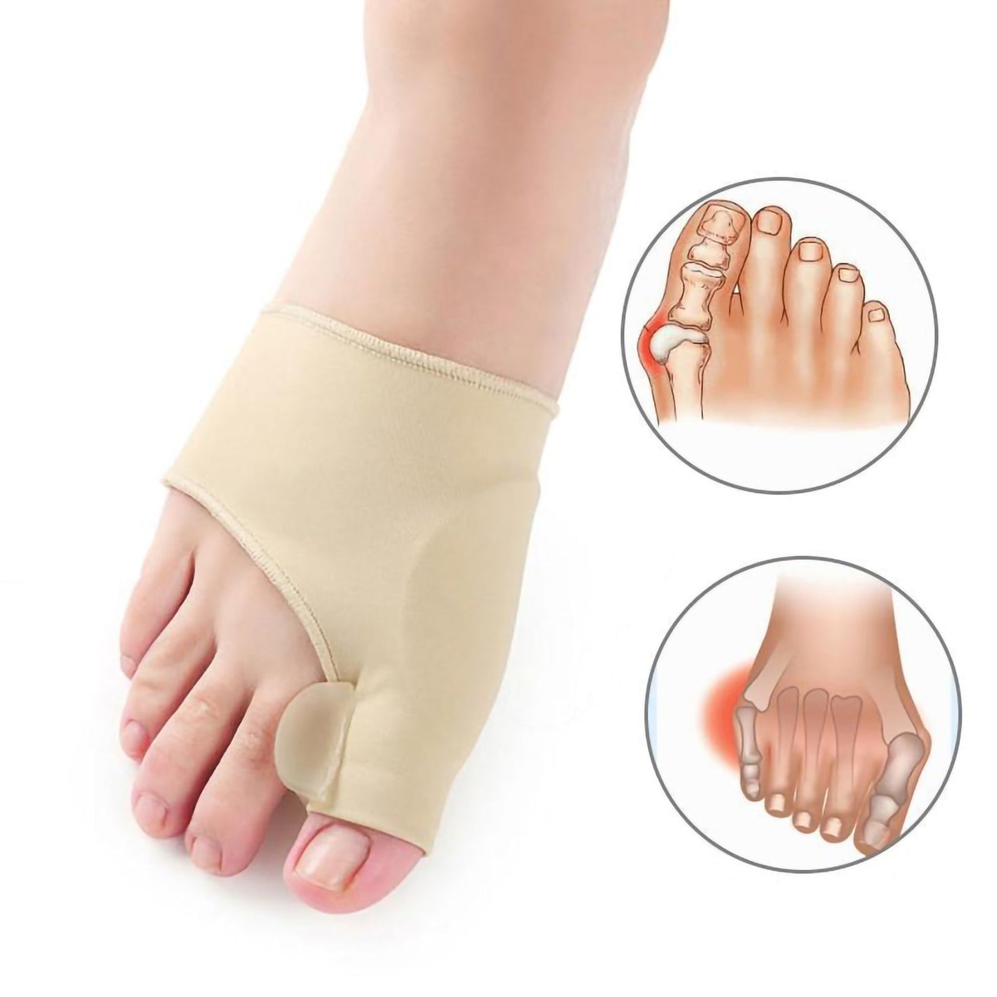 Skorter | Bunion Orthopedic Corrector Sleeve