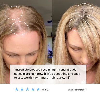 Skorter | Cordless Scalp Massaging Brush – Boost Hair Growth & Relax at Home