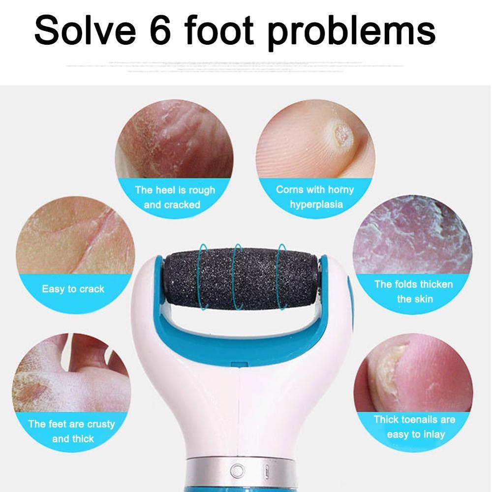 Skorter | Callus Remover Foot Grinder Pedicure