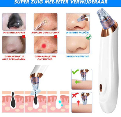 Skorter | Electric Blackhead Remover