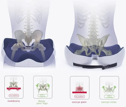 Skorter | Adjustable Memory Foam Seat Cushion for Sit Bone Relief | Ergonomic Design for Office Chair and Car Use