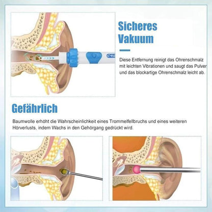Skorter | Earwax remover vacuum