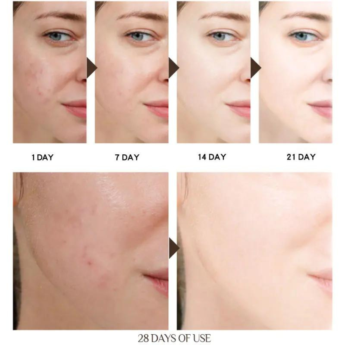 Skorter | Anti-Aging & Dark Spot Remover