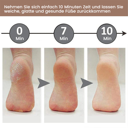 Skorter | Foot Sander