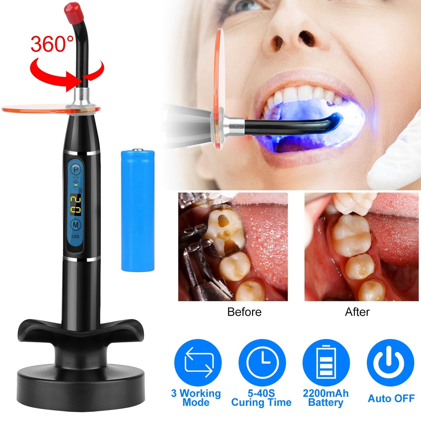 Skorter | 5W Wireless Dental LED Curing Light