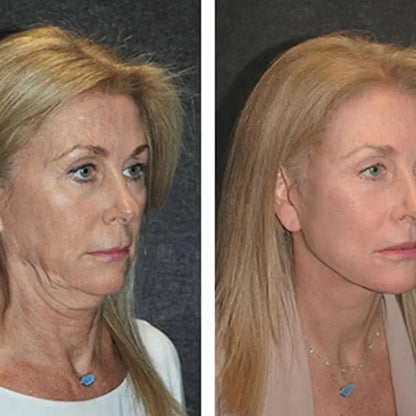 Skorter | Collagen Gel & Firming Night Mask