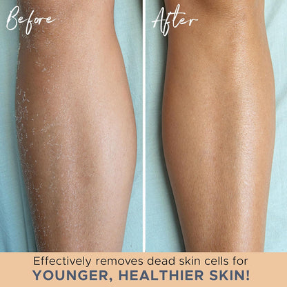 Skorter | Exfoliating Bath Gloves – Set of 2