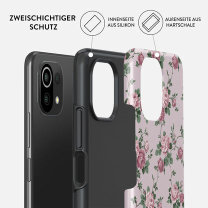 Skorter | Alice - Xiaomi 11 Lite 5G NE Case