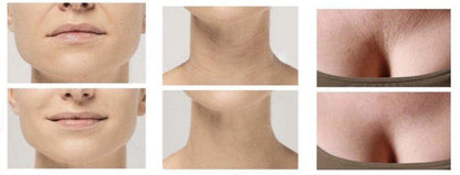 Skorter | Anti-Wrinkle Silicone Pads