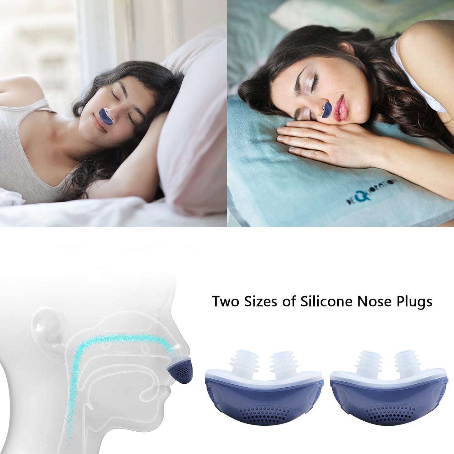 Skorter | Anti-Snoring Device | Tubeless, maskless micro-CPAP