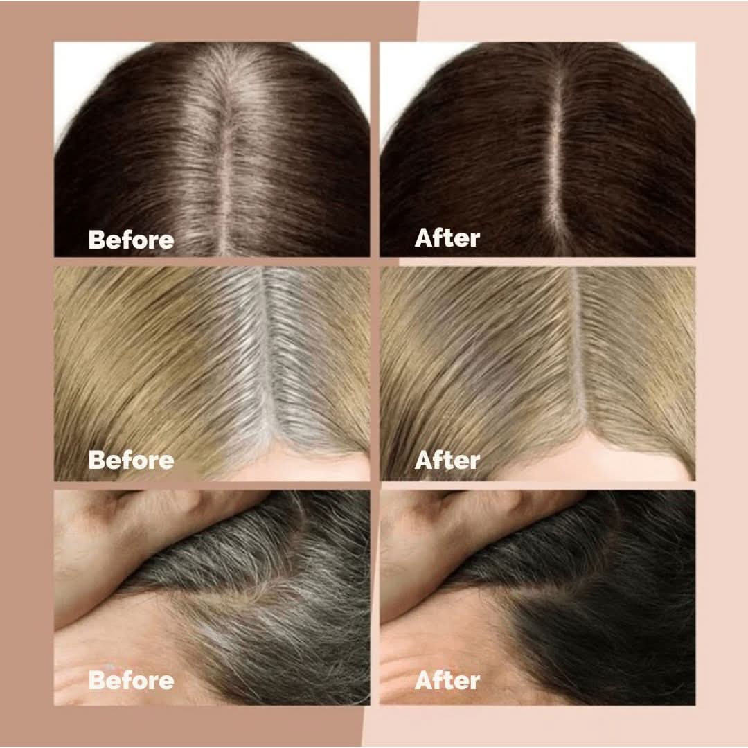 Skorter | Easyblend - Color Roots & Regrowth