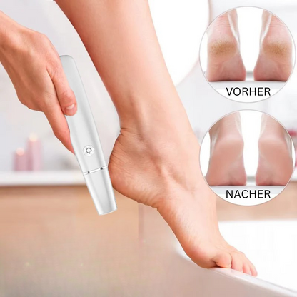 Skorter | Electric Callus Remover for the Feet