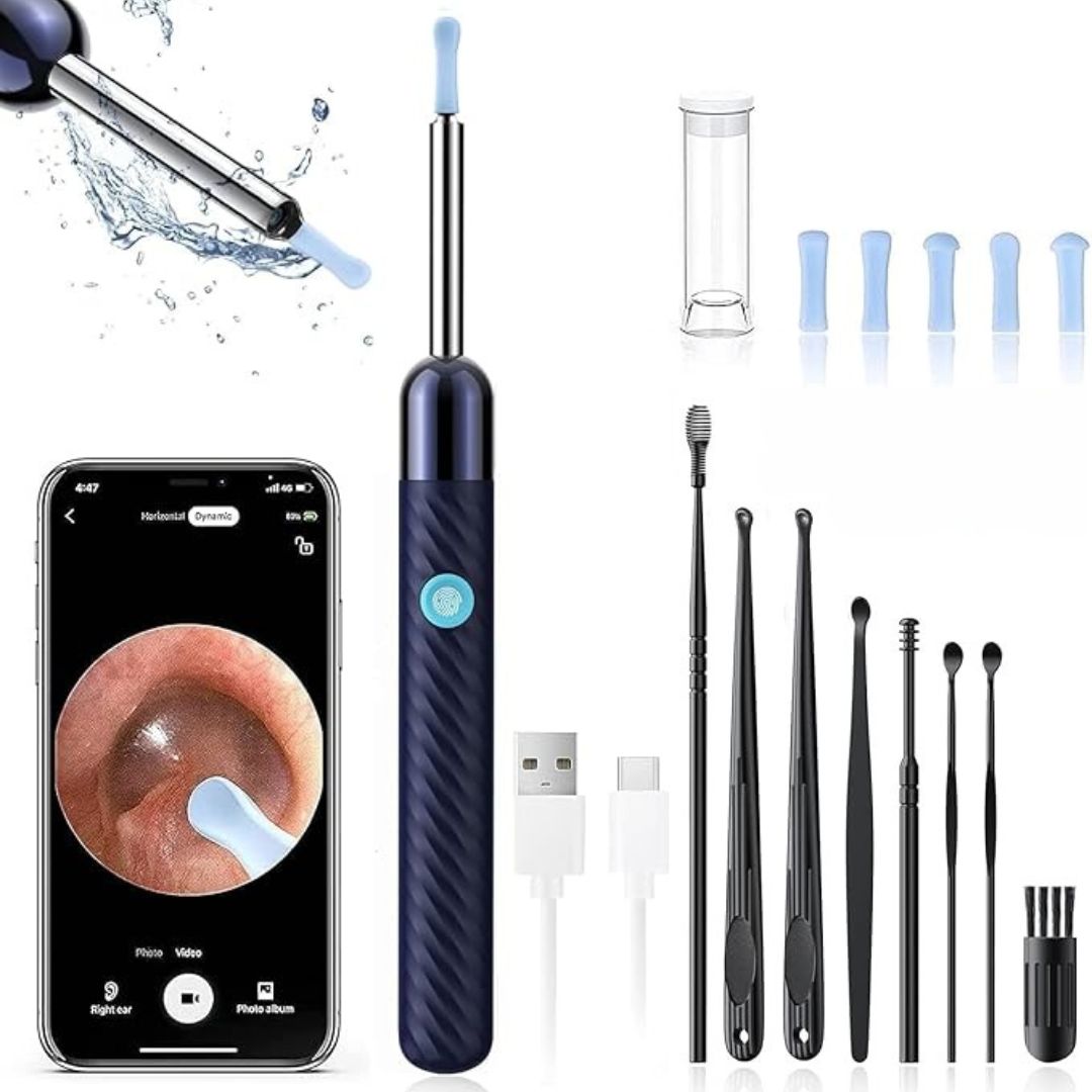 Skorter | Ear Wax Removal Tool | 1080P HD Camera, LED Lights & Adjustable Scoops for Safe Ear Hygiene at Home