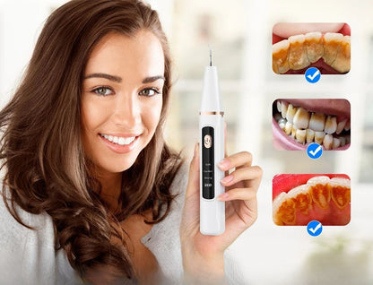 Skorter | Ultrasonic Teeth Cleaning Device | 38 kHz Ultrasound, LED Light & USB Fast Charging for Home Dental Care
