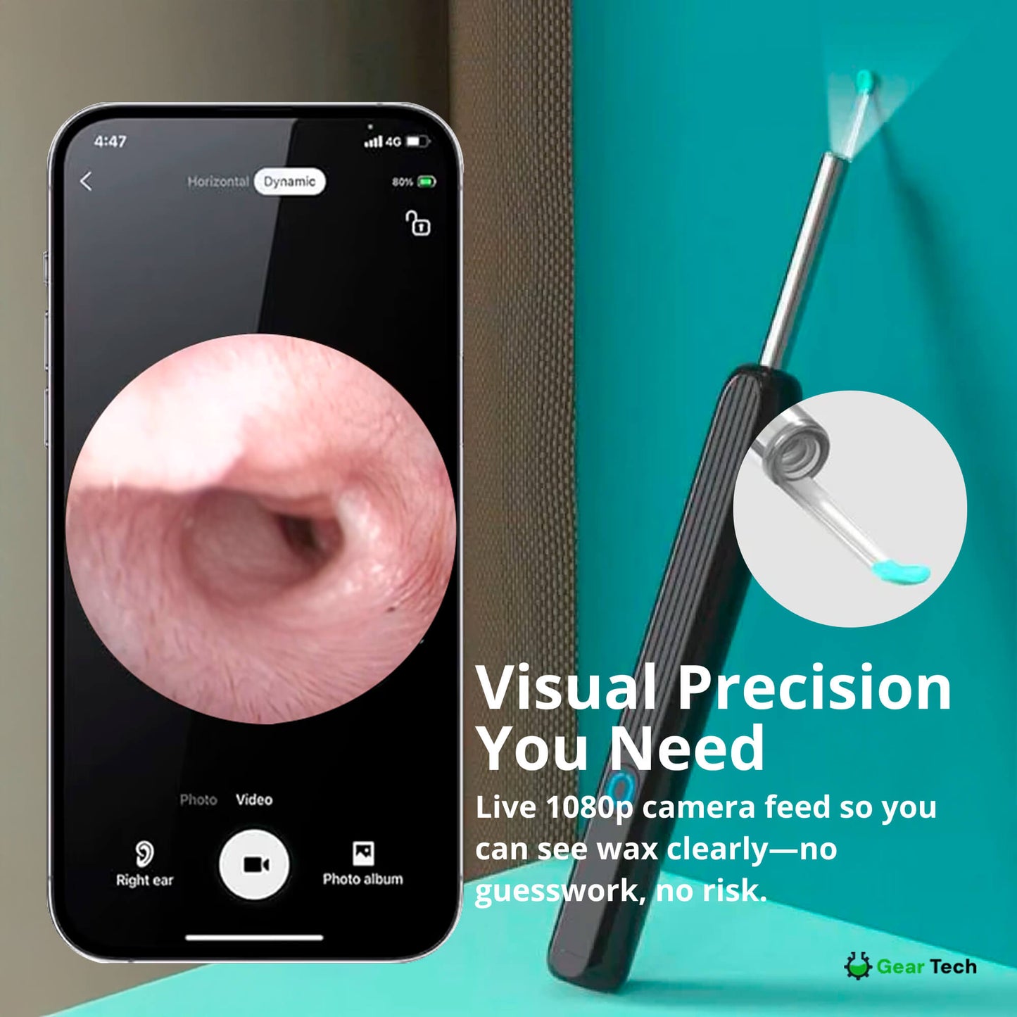 Skorter | EarScope Pro Ear Wax Removal Kit | High-Resolution Camera & LED Lights for Safe Home Use