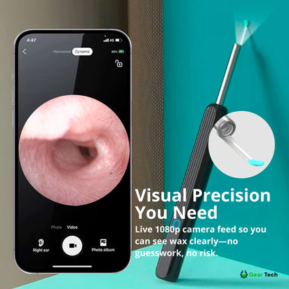Skorter | EarScope Pro Ear Wax Removal Kit | High-Resolution Camera & LED Lights for Safe Home Use