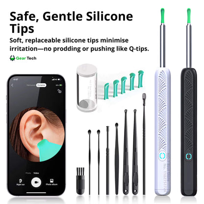 Skorter | EarScope Pro Ear Wax Removal Kit | High-Resolution Camera & LED Lights for Safe Home Use