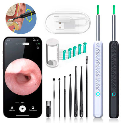 Skorter | EarScope Pro Ear Wax Removal Kit | High-Resolution Camera & LED Lights for Safe Home Use