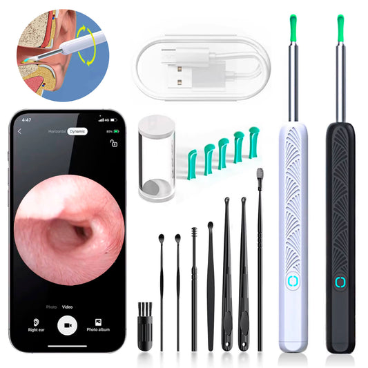 Skorter | EarScope Pro Ear Wax Removal Kit | High-Resolution Camera & LED Lights for Safe Home Use