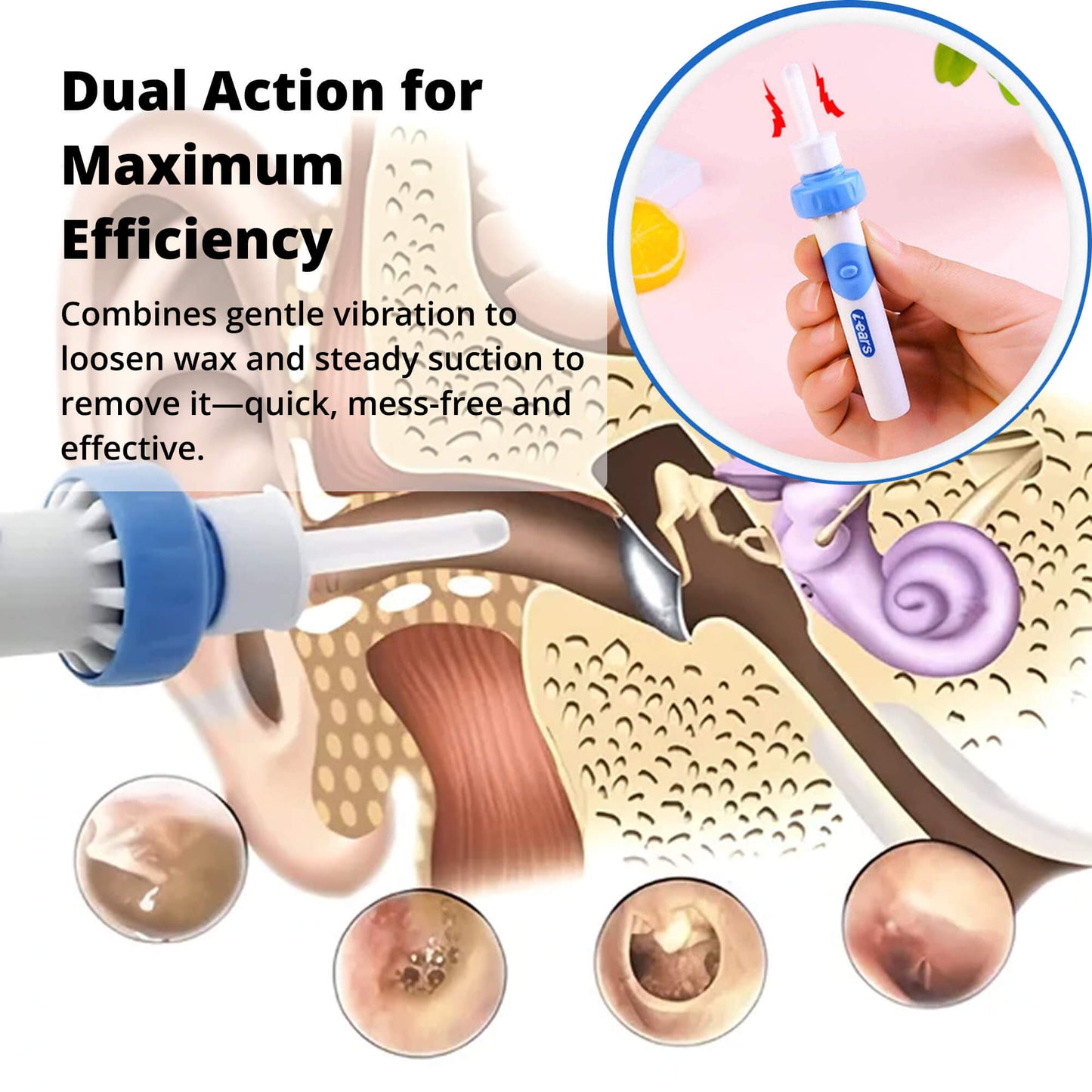 Skorter | Electric Ear Suction Wax Removal Tool | Ergonomic, Silicone Tip & Compact Design for Safe Ear Hygiene at Home or Travel