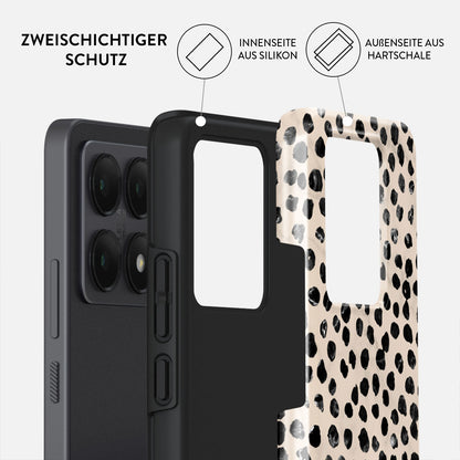 Skorter | Almond Latte - Xiaomi 14T Case