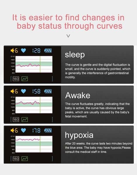 Skorter | Doppler Ultrasound Heartbeat Detector