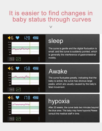 Skorter | Doppler Ultrasound Heartbeat Detector