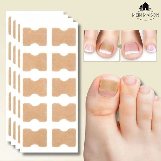 Skorter | FixaNail – Painless nail correction for ingrown & deformed nails