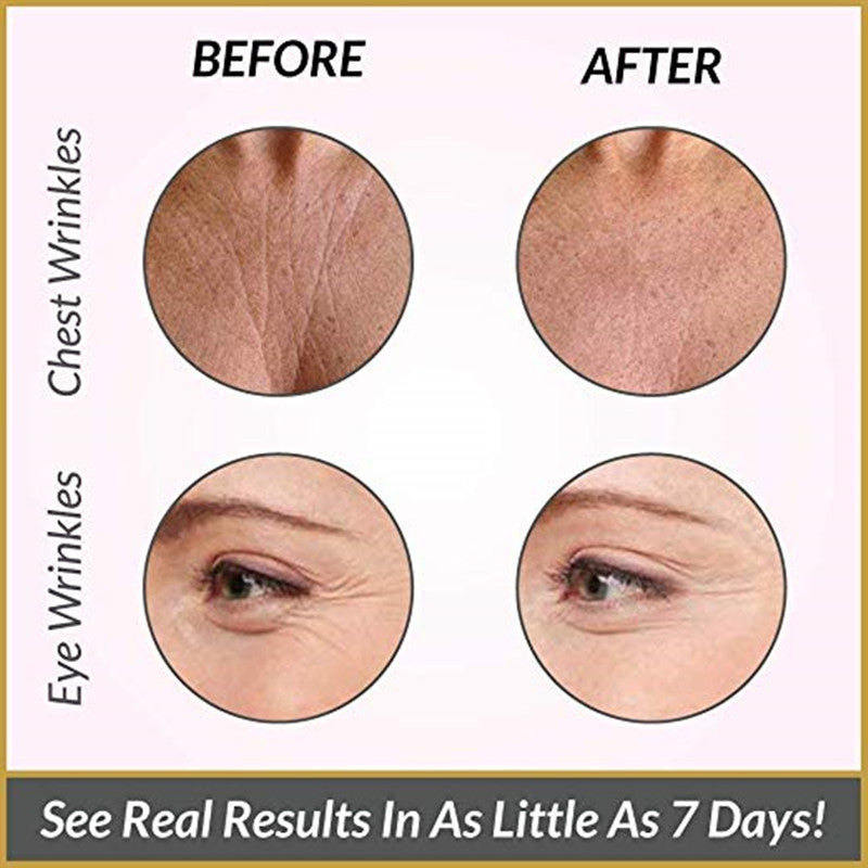 Skorter | Anti-wrinkle-mask