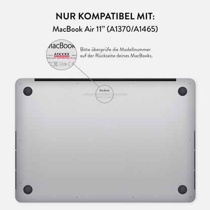 Skorter | Aries - Macbook Hard Case