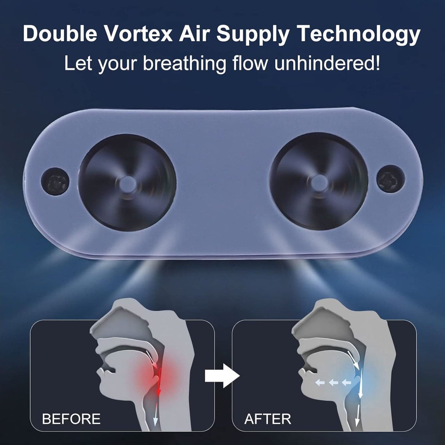 Skorter | Anti-Snoring CPAP Device without Mask for Quiet Sleep & Free Breathing