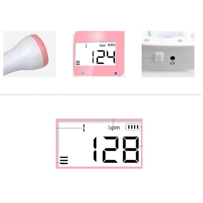 Skorter | Fetal Doppler Fetal Ultrasound Baby Heartbeat
