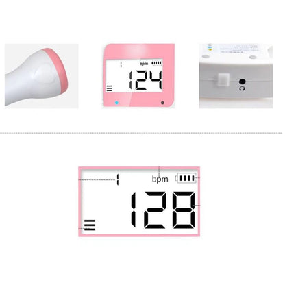 Skorter | Fetal Doppler Fetal Ultrasound Baby Heartbeat